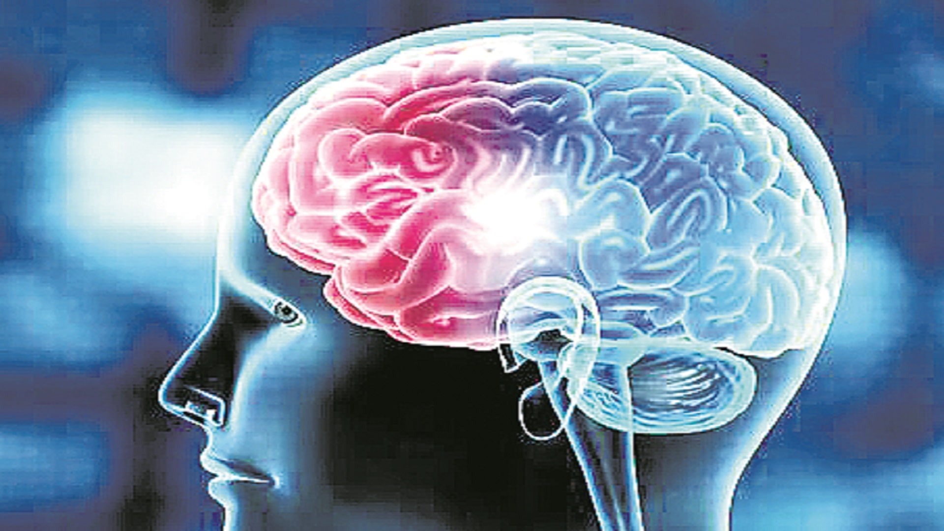 దేశీయ బ్రెయిన్‌ స్టెంట్‌